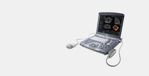GE Voluson i Portable Ultrasound 3D 4D